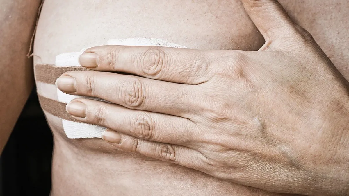 Växtmolekyl visar potential mot aggressiv bröstcancer